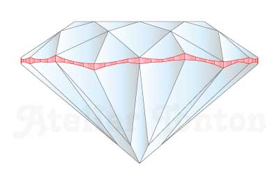 波打ったガードルル